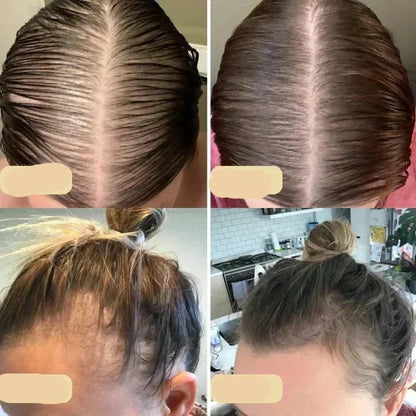 Veganes Haarwuchsöl | Natürlicher Booster  Für Gesundes Haarwachstum