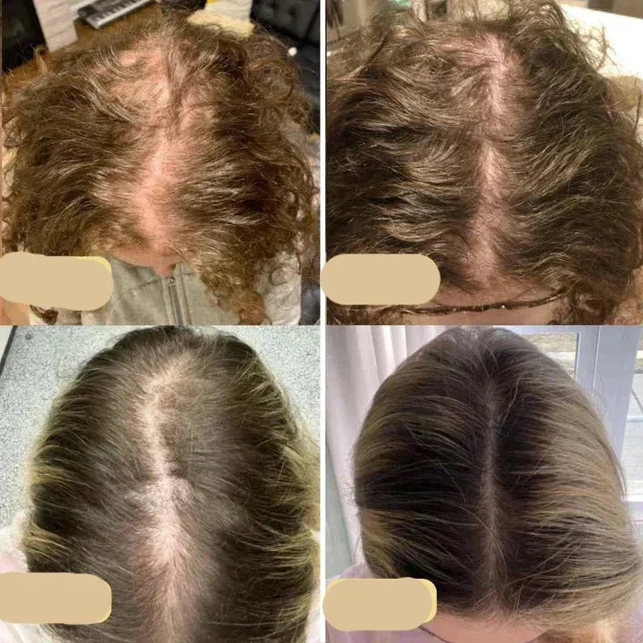 Veganes Haarwuchsöl | Natürlicher Booster  Für Gesundes Haarwachstum