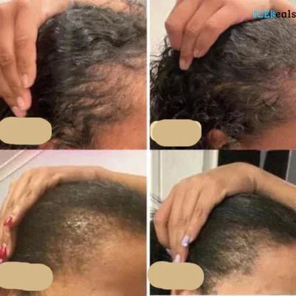 Veganes Haarwuchsöl | Natürlicher Booster  Für Gesundes Haarwachstum
